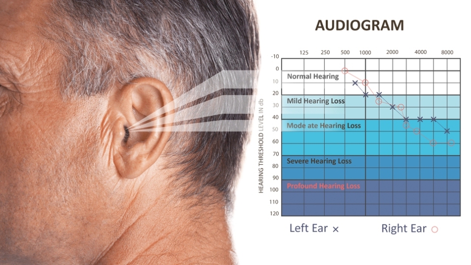 Audiograma